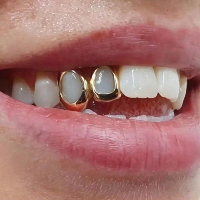 Conjunto de Joias Dentárias Go - Body Jewelry Lot avaliação e preço